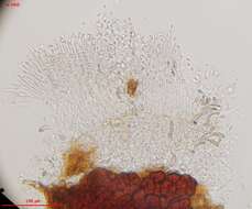 Image of Stilbotulasnella conidiophora Bandoni & Oberw. 1982