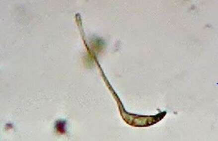 Image of Lacrymaria olor