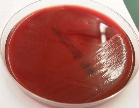 Image de Clostridium perfringens