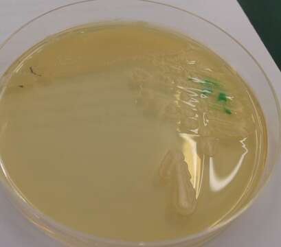 Image de Bacillus cereus