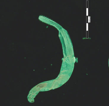 Image of <i>Telosentis exiguus</i> (von Linstow 1901)