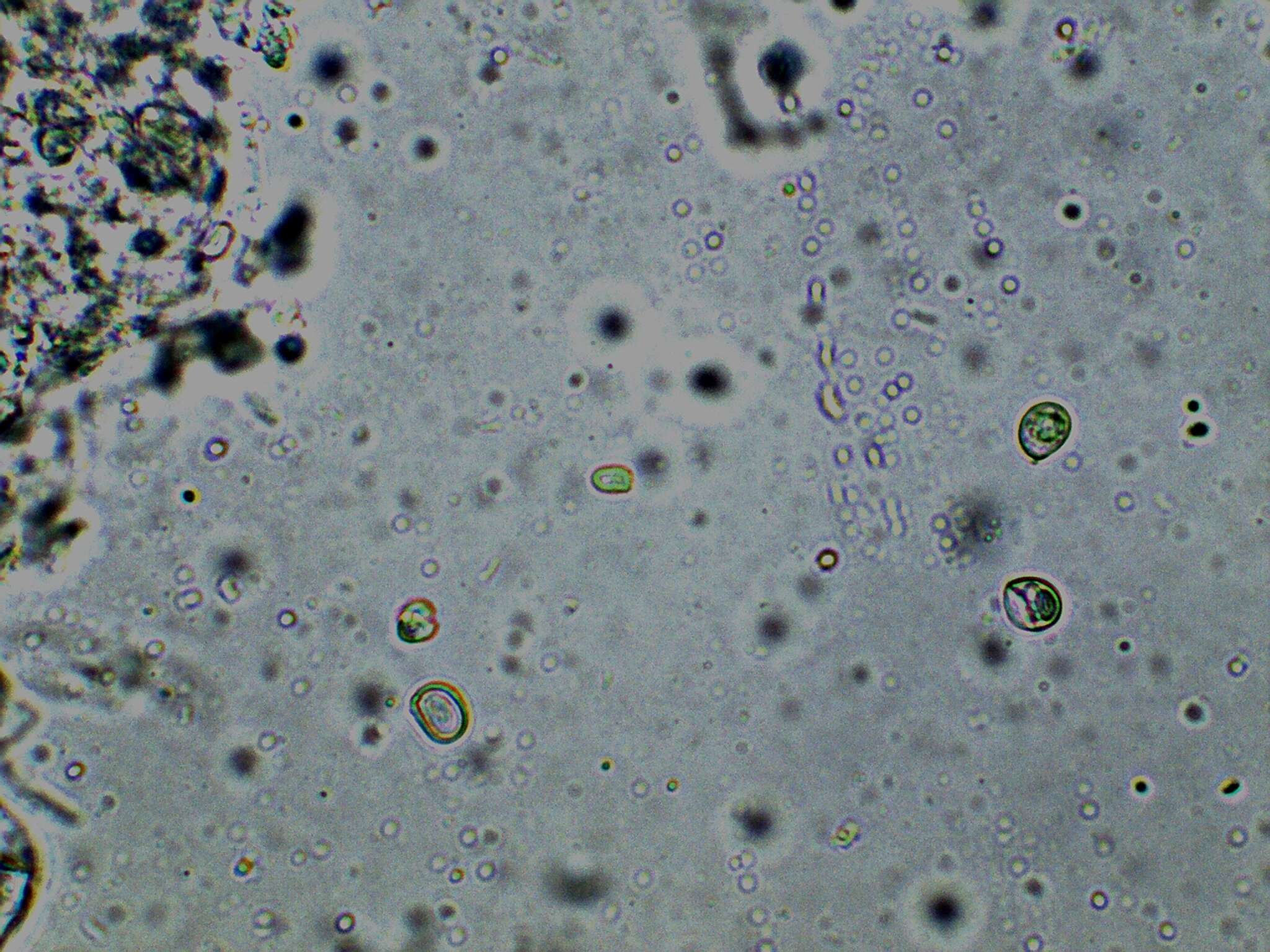 Image of Cystolepiota seminuda (Lasch) Bon 1976