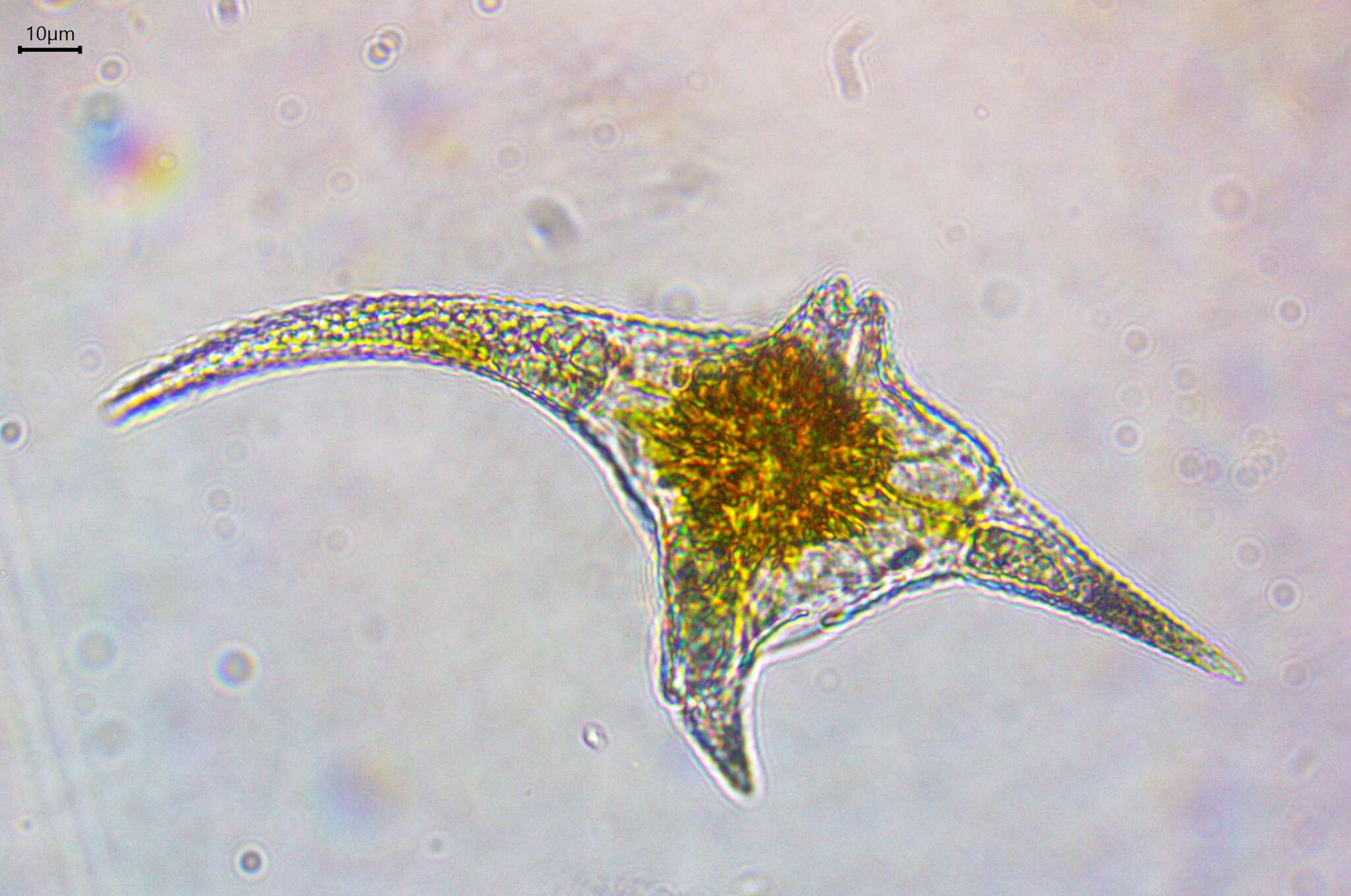 Image of Ceratium carolinianum (Bailey) E. G. Jørgensen 1911