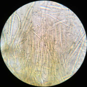 Image of Trichopeziza subsulphurea (Svrček) Baral 1993