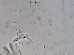 Plancia ëd Eupezizella aureliella (P. Karst.) T. Kosonen, Huhtinen & K. Hansen