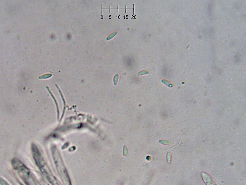 Image of Eupezizella aureliella (P. Karst.) T. Kosonen, Huhtinen & K. Hansen