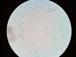 Image of Ascocoryne cylichnium (Tul.) Korf 1971