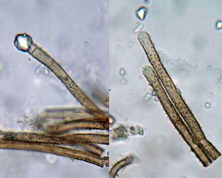 Image of Brunnipila calyculiformis (Schumach.) Baral 1985