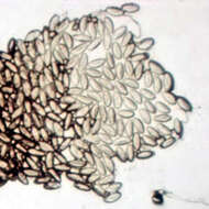 Image of Pinworm