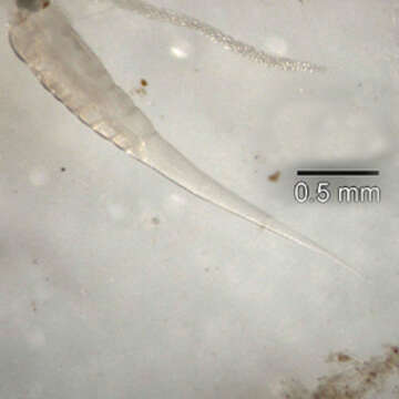 Image of Pinworm