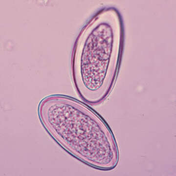 Image of Pinworm