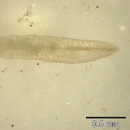 Image of Pinworm