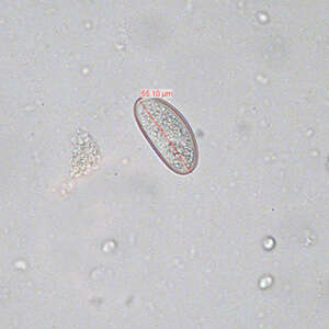 Image of Pinworm