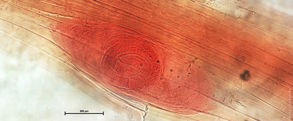 Image of <i>Trichinella spiralis</i> (Owen 1835)