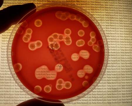 Plancia ëd Streptococcus agalactiae