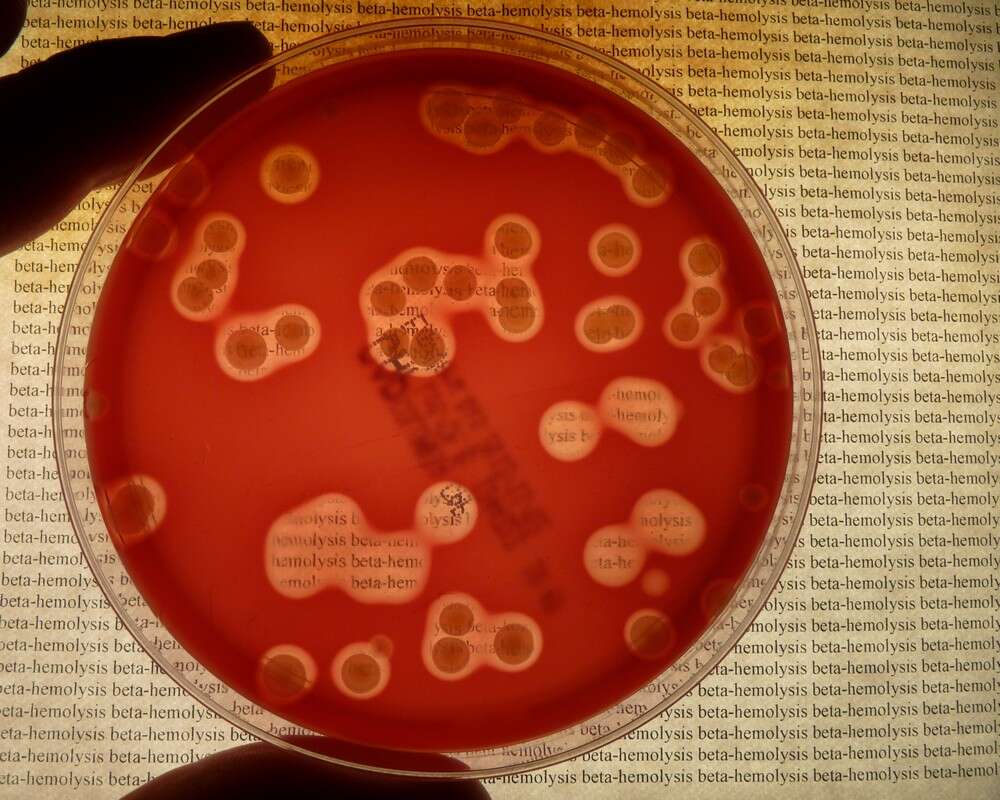 Image of Streptococcus agalactiae