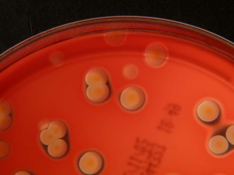 Image de Streptococcus agalactiae