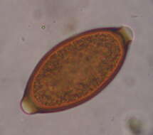 Слика од <i>Trichuris vulpis</i>