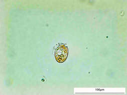 صورة Dinophysis acuminata