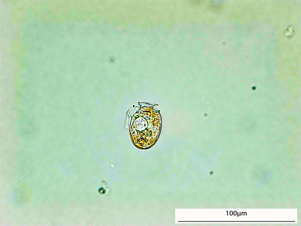 Image of Dinophysis acuminata