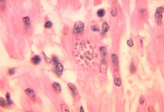 Image of Trypanosoma subgen. Schizotrypanum