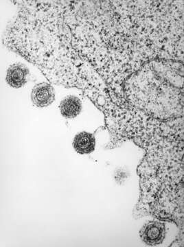 Image of Human herpesvirus 6