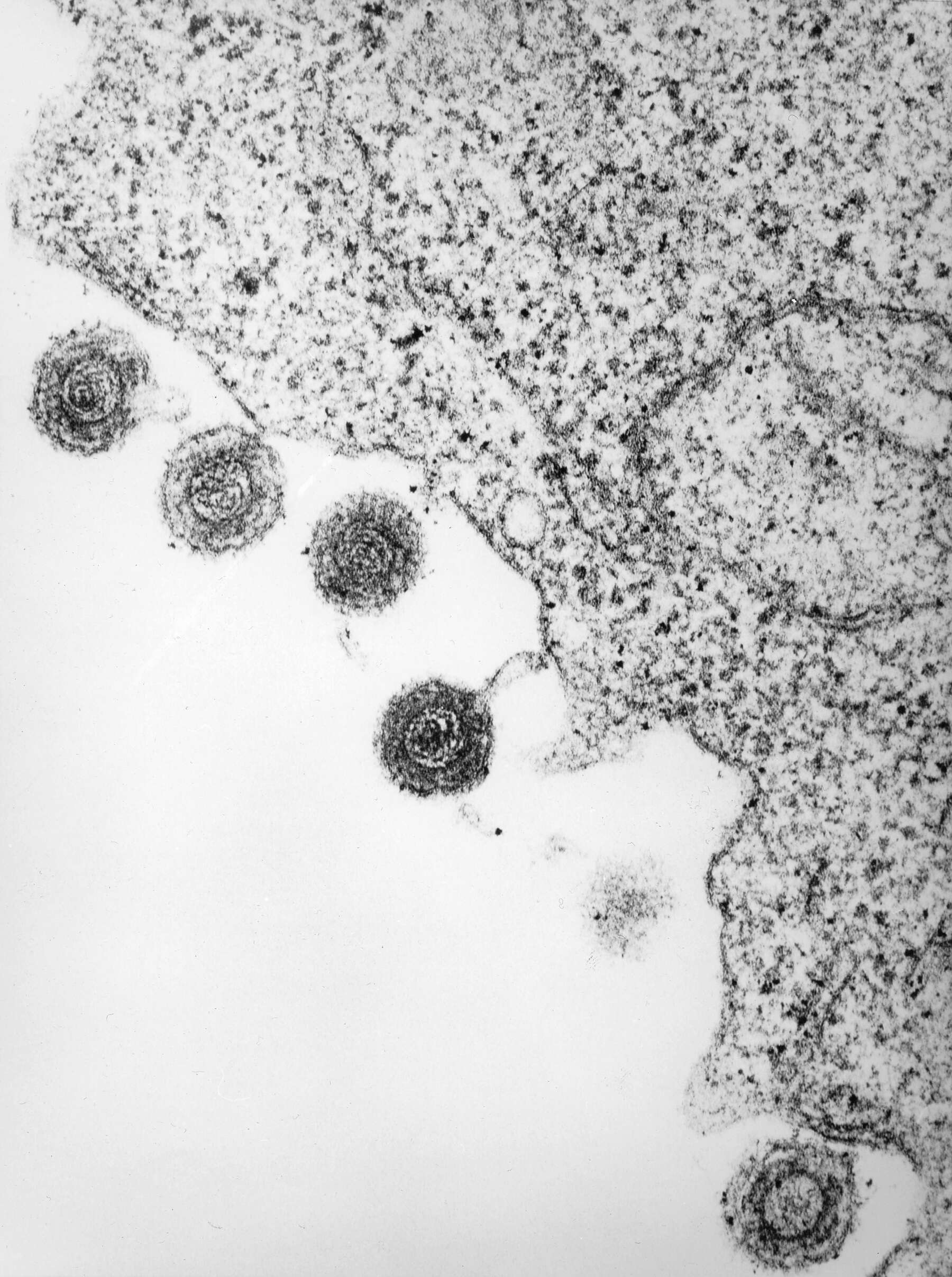 Image de Roseolovirus