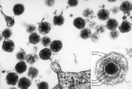 Image de Human herpesvirus 6