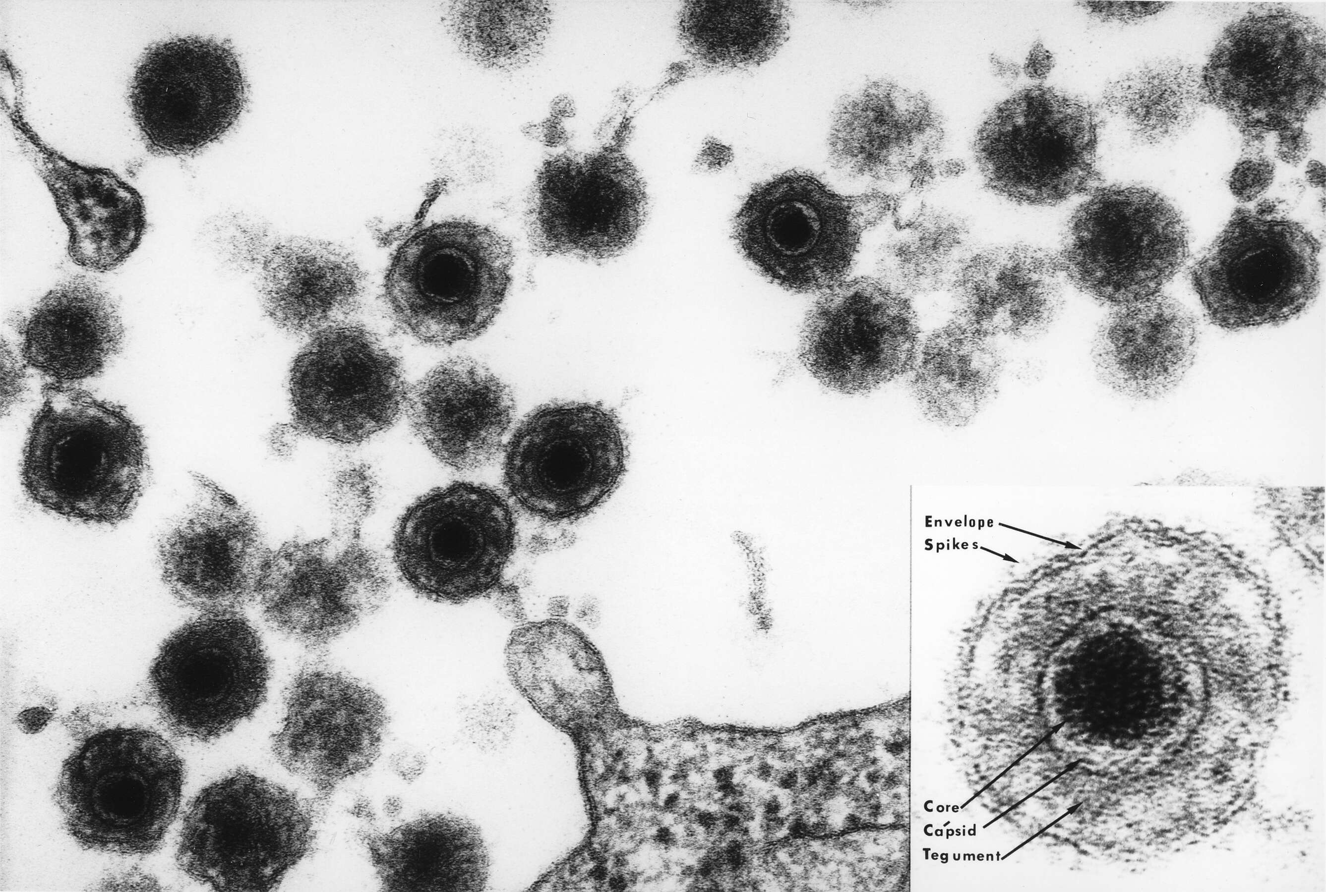 Image of Human herpesvirus 6