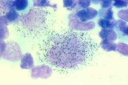 Image of Human herpesvirus 6