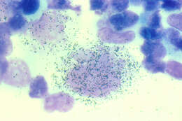 Image de Human herpesvirus 6