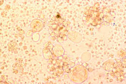 Image of Roseolovirus
