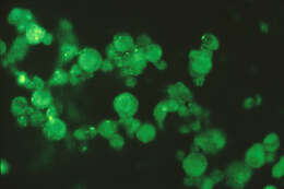 Image de Human herpesvirus 6