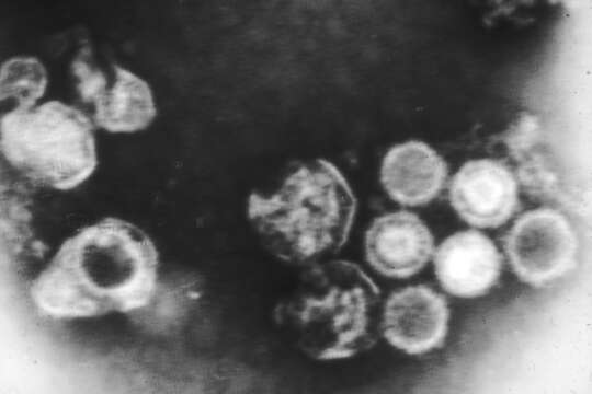Image of Human herpesvirus 4