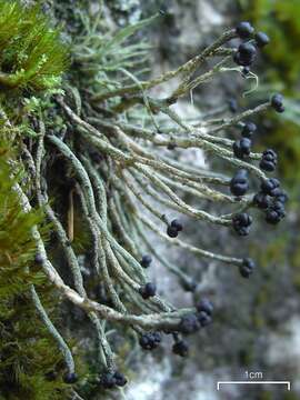 Image of nail lichen