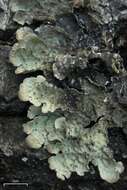 Image of lung lichen