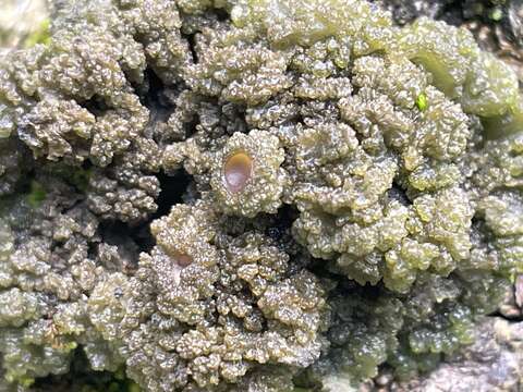 Image of skin lichen