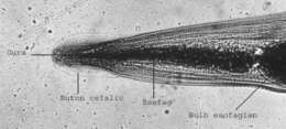 Image of Pinworm