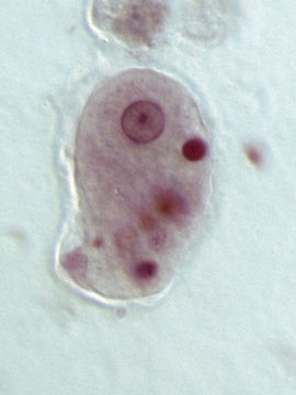 Image of <i>Entamoeba histolytica</i>