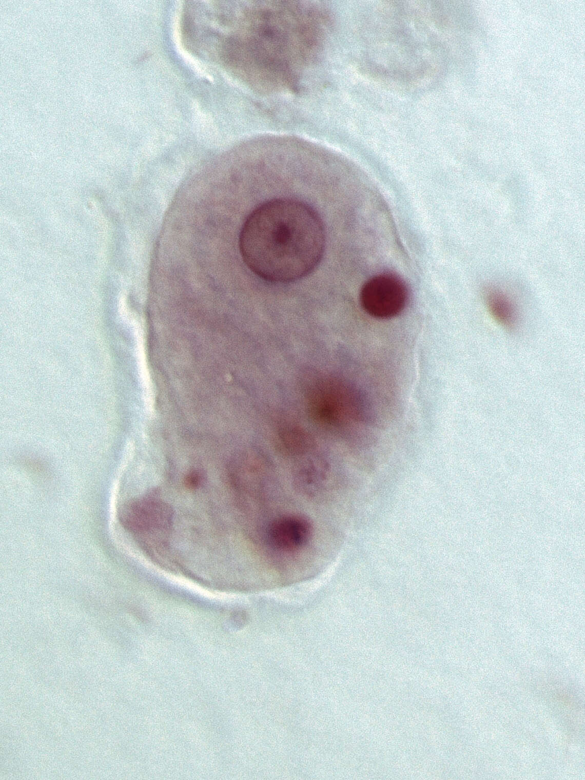 Image of Entamoebidae