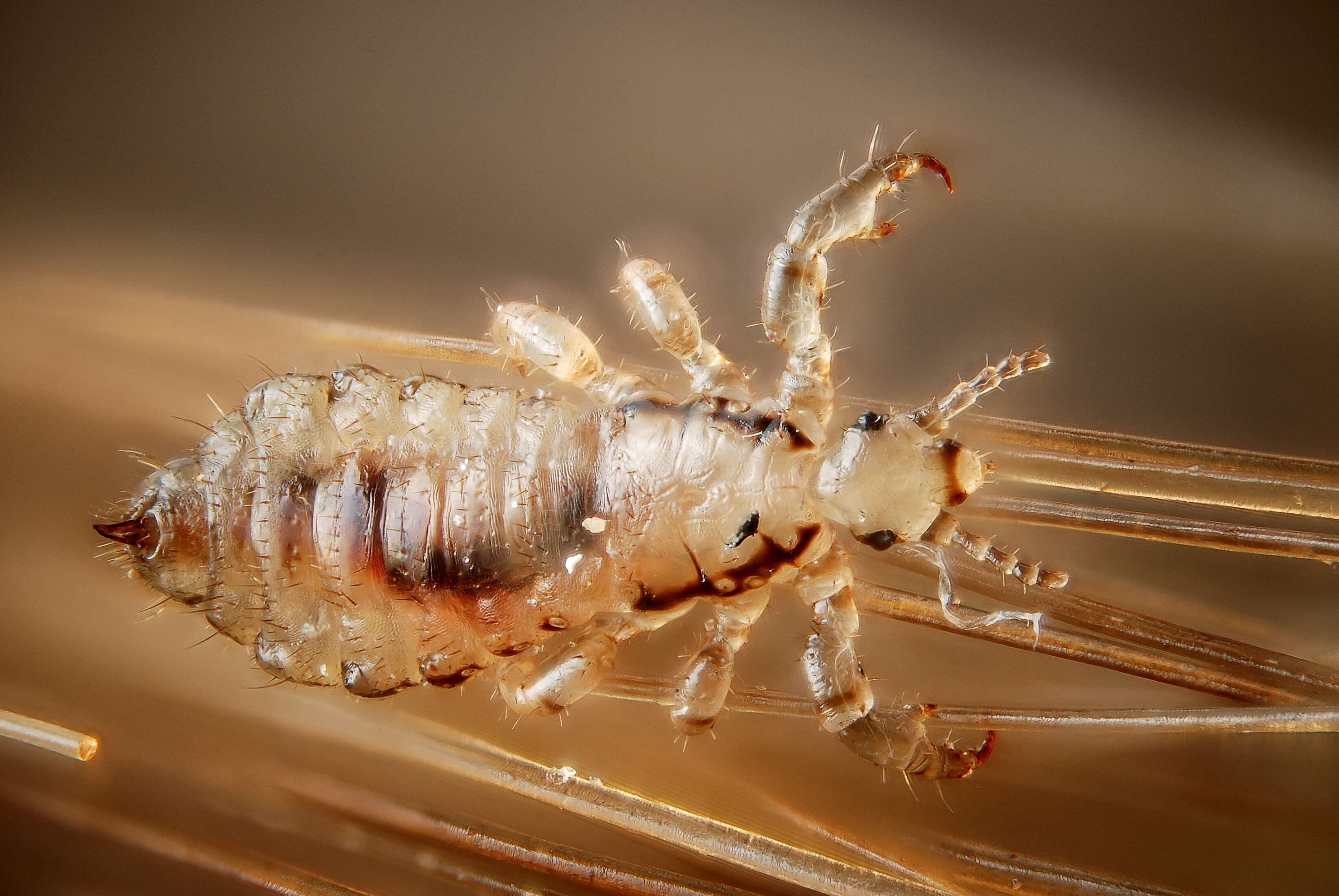 Image of head louse