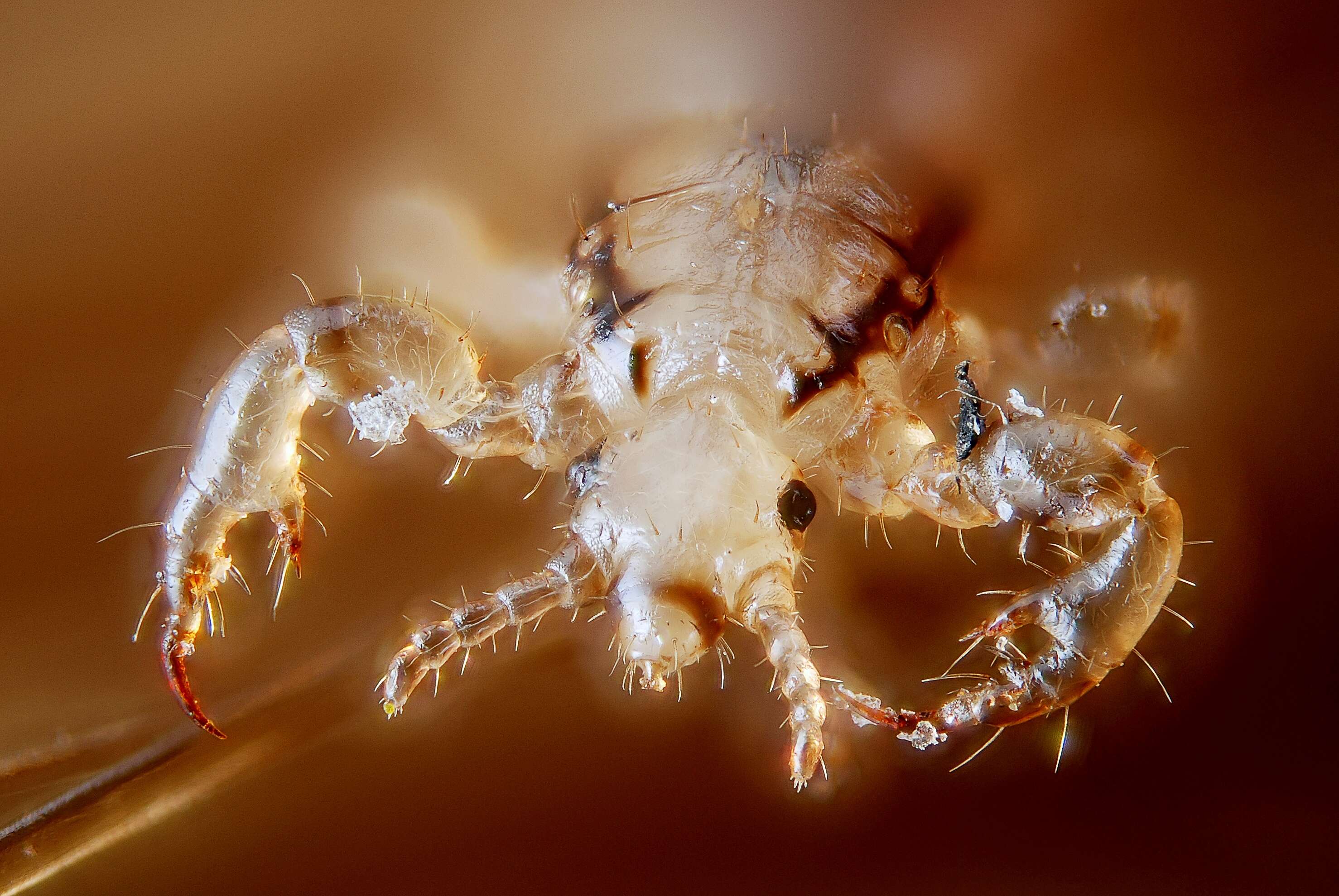 Image of head louse