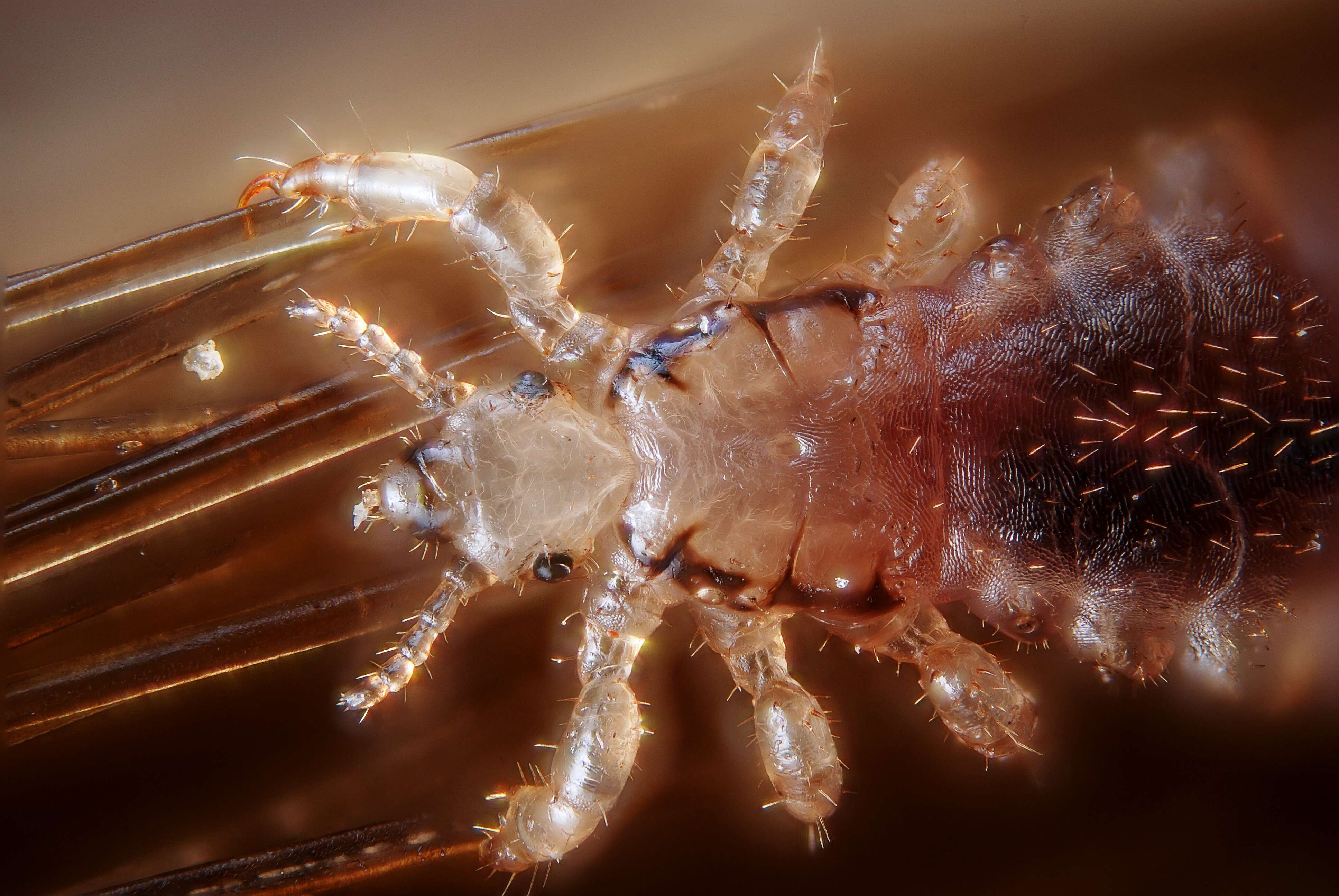 Image of head louse