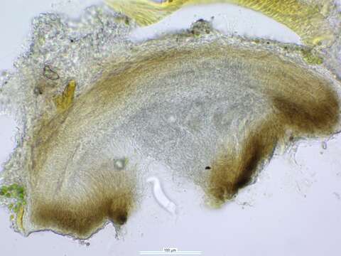 Image of chromatochlamys lichen