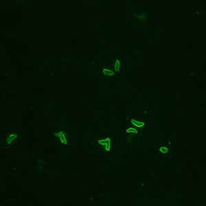 Image de Toxoplasma