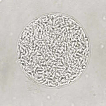 Image of Toxoplasma