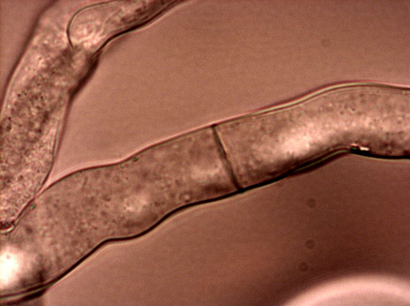 Image of Neurospora