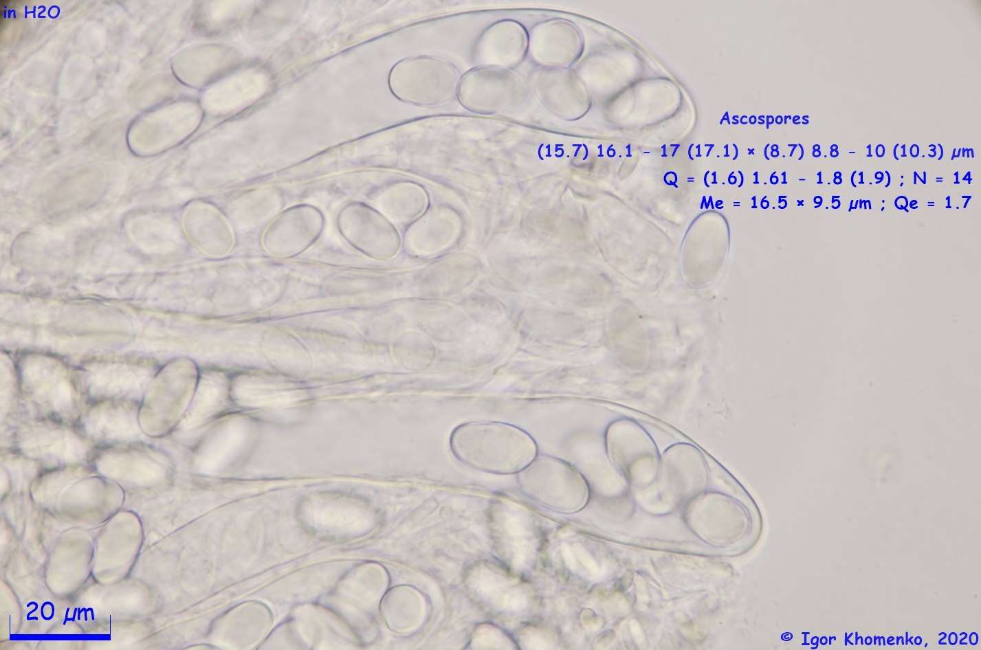 Imagem de Lasiobolus intermedius J. L. Bezerra & Kimbr. 1975