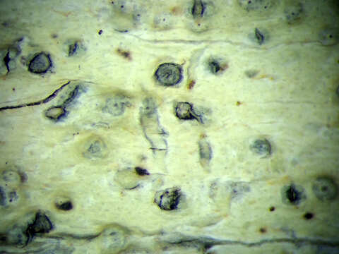 Image of wart lichen