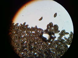 Image de Pyrenomyxa picea (Ellis) M. Stadler, Læssøe & Lar. N. Vassiljeva 2006